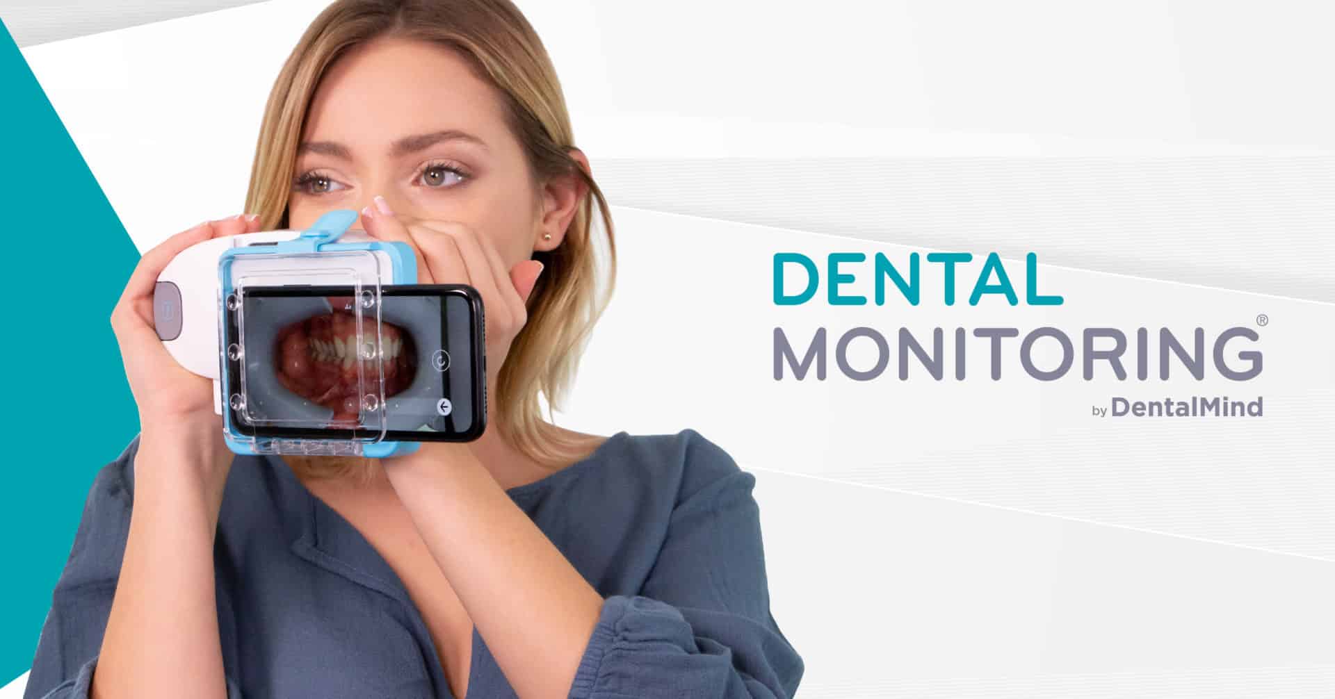Dental Monitoring - Clínica dental González Baquero