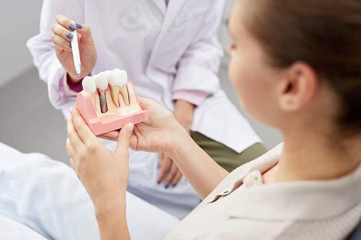 Implantes dentales en un solo día: procesos y tipos