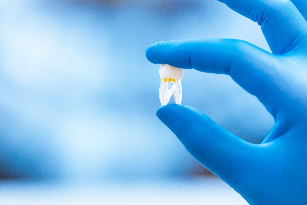 Síntomas de una corona dental mal puesta: soluciones y alternativas