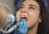 Funciones higienista dental