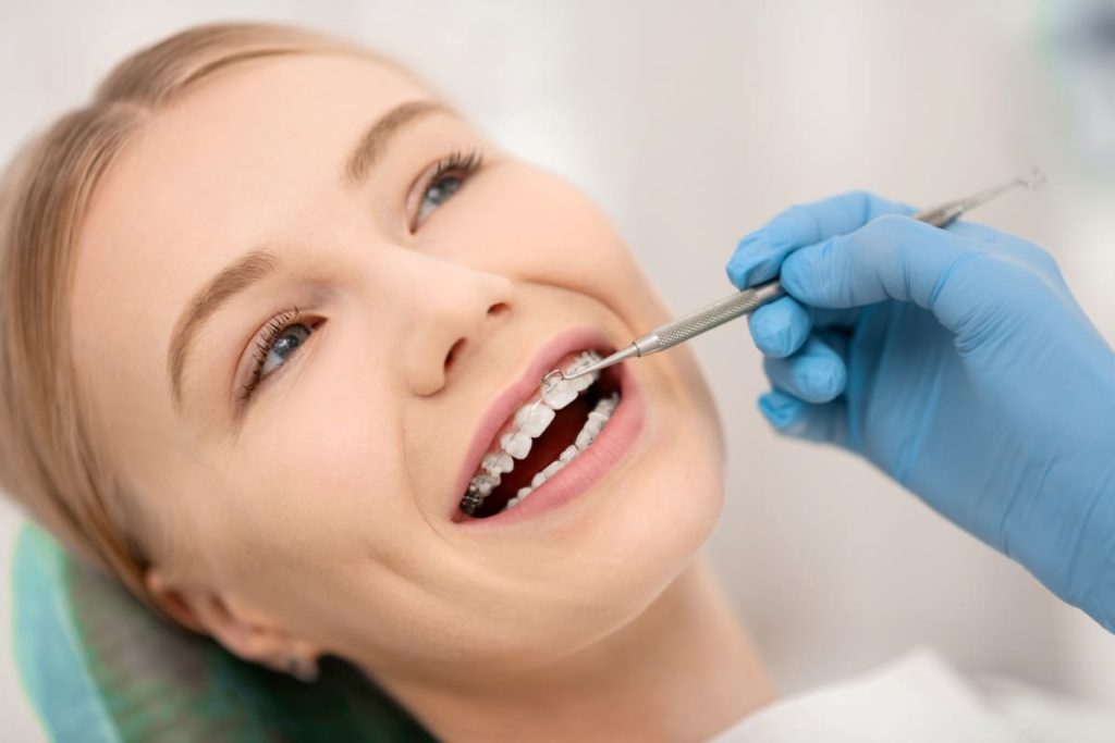 Gomas en ortodoncia: aprende para qué sirven