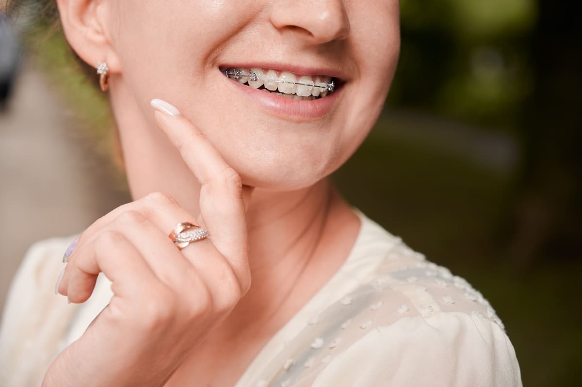 ¿Qué tipos de ortodoncias existen? ¿Cúal elegir?