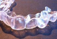 10 ventajas de Invisalign, la ortodoncia invisible