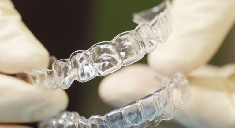 ferulas-dentales-1-min