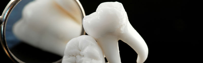 El futuro de la implantología dental