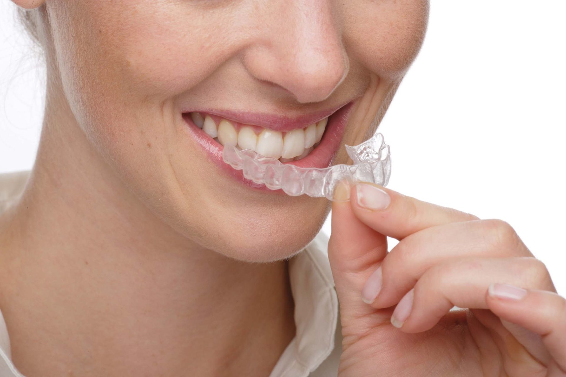 Los tratamientos dentales en el deterioro de los dientes