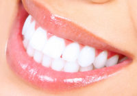 Invisalign, la ortodoncia invisible en la sobremordida