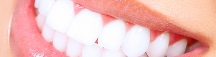Carillas Dentales, la revolución en la estética dental