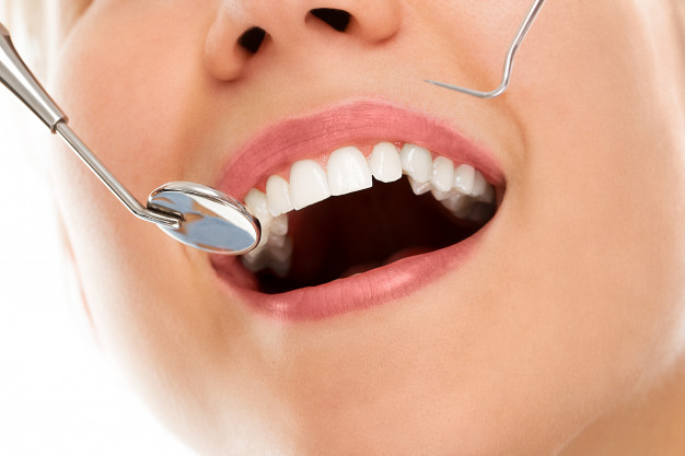 Esmalte dental dañado, ¿cómo tratarlo?
